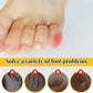 Silicone toe protector