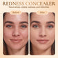 Long-Wear 5-Color Concealer Palette for a Flawless Finish